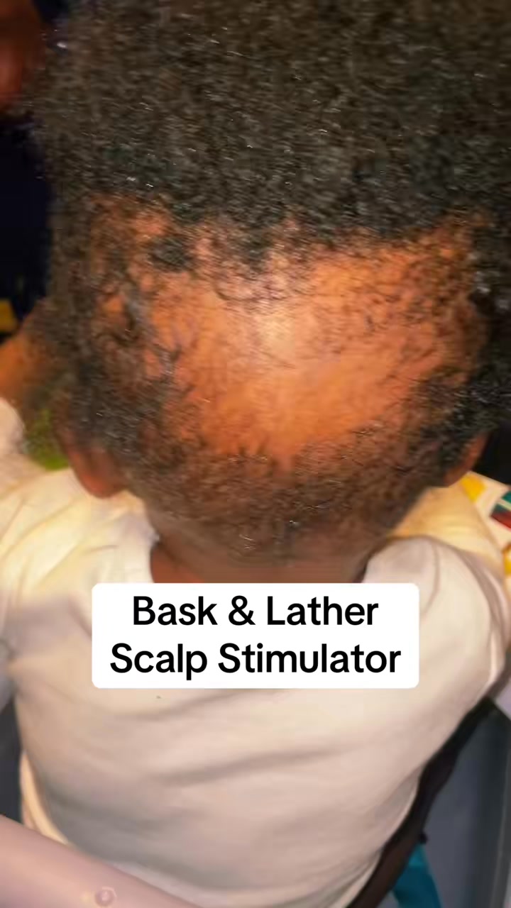 Scalp Stimulator