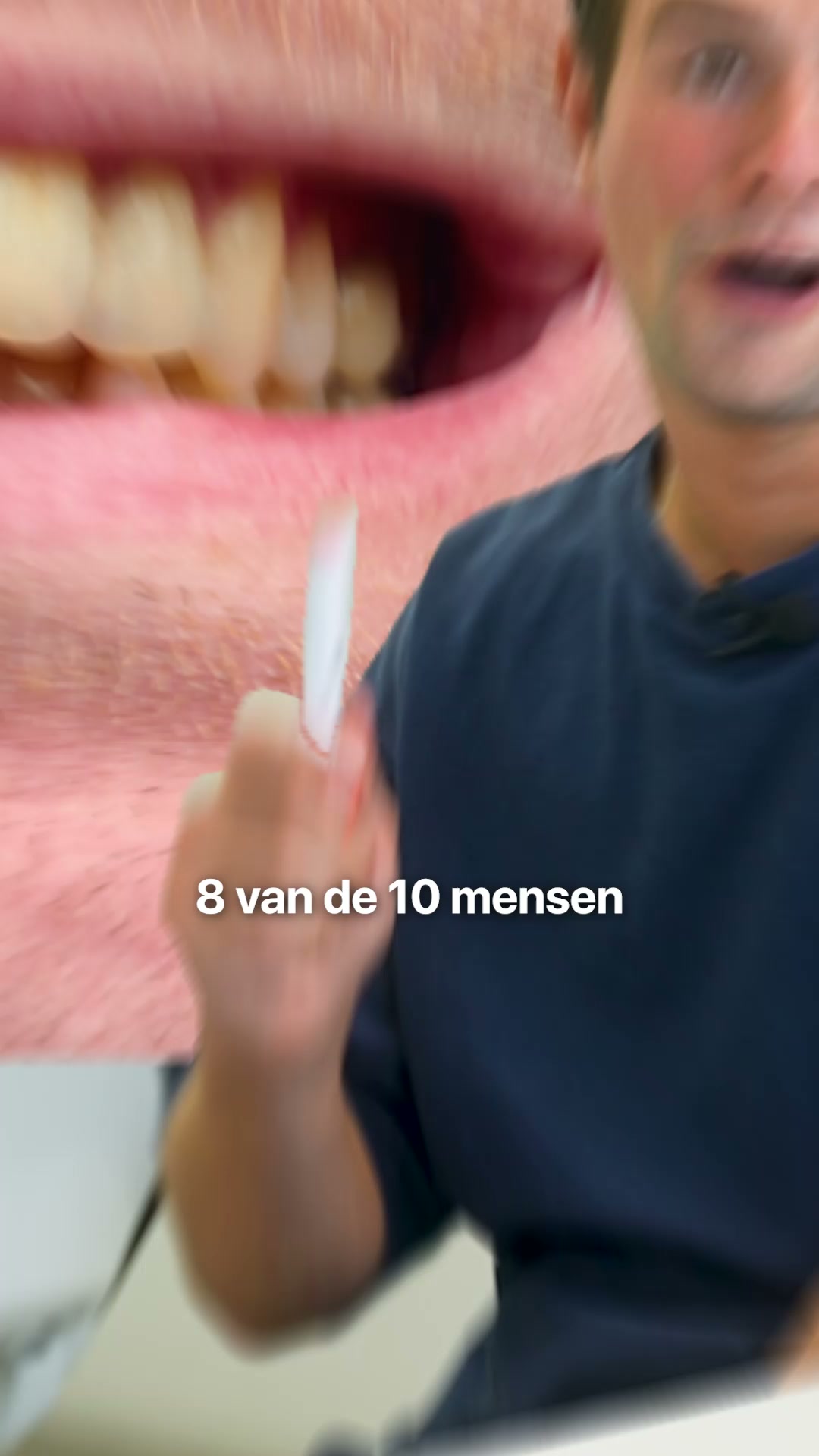 Trots op je glimlach?
