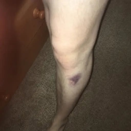 One Trip A Night By Week Three, And A Fuller Crown By Month Six