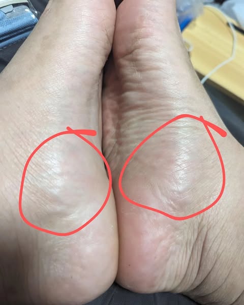 Tus pies siguen teniendo una oportunidad