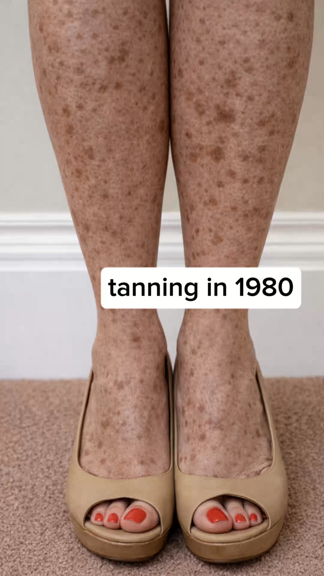 Designed for Age Spots.