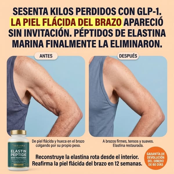Ultimas Unidades Gratis