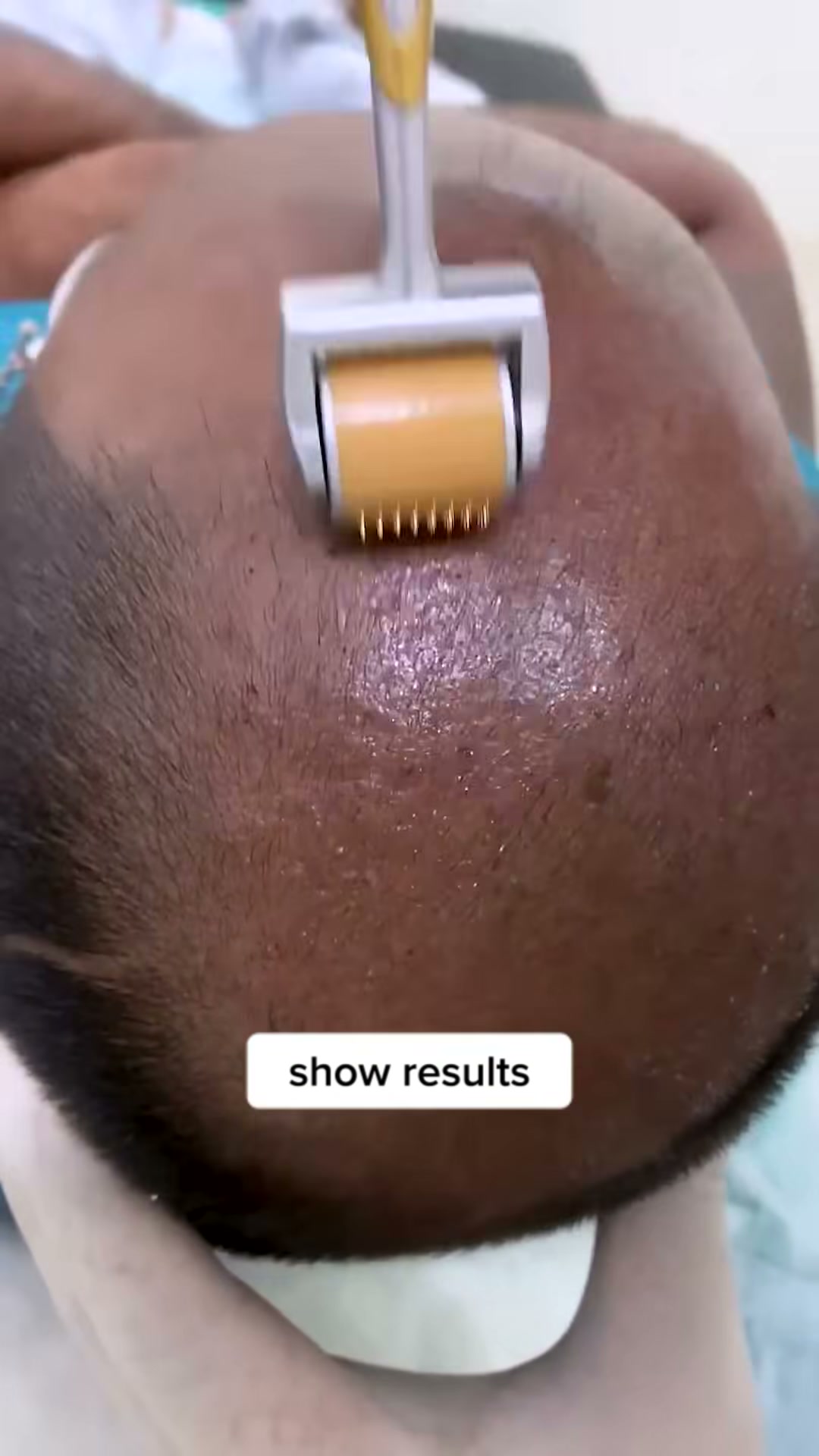 Instantly Get Fuller, Thicker Hair Naturally