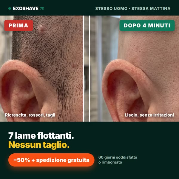 Approfitta oggi del 50% di sconto su Exoshave.