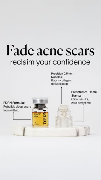 Fade Post-Acne Scars at Home