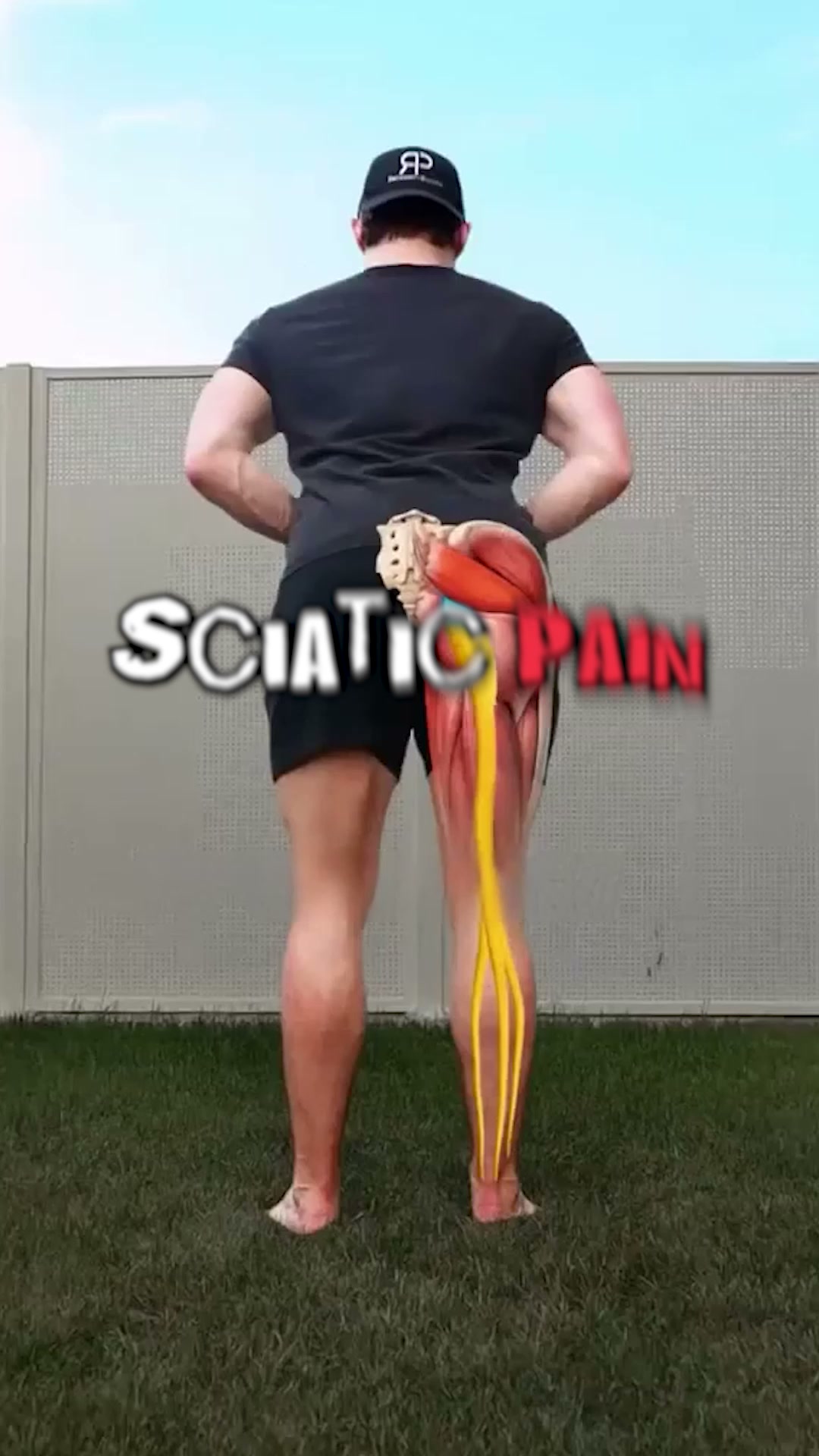 Sciatica Stole 3 Years Of My Life. This Stops The Progression Overnight While You Sleep