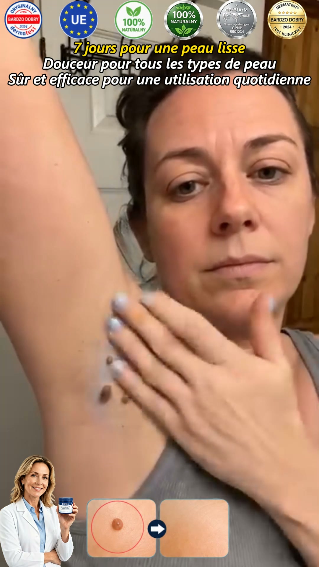 Wir präsentieren die „7-Day Skin Tag & Spot Eraser Cream“
