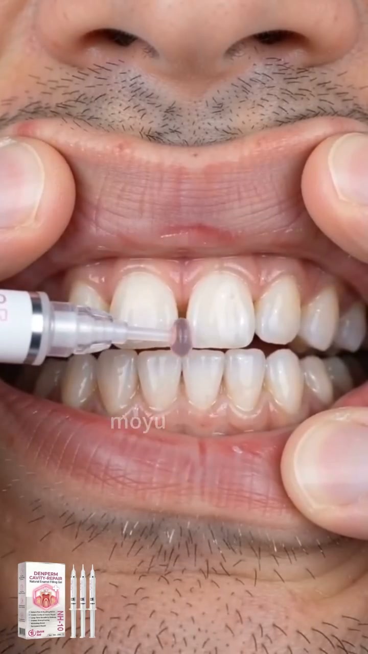 Cavity Repair FDA-Recognized 10% Nano-Hydroxyapatite (NH-10) | Delivery within 2-4 working days | Full refund guarantee