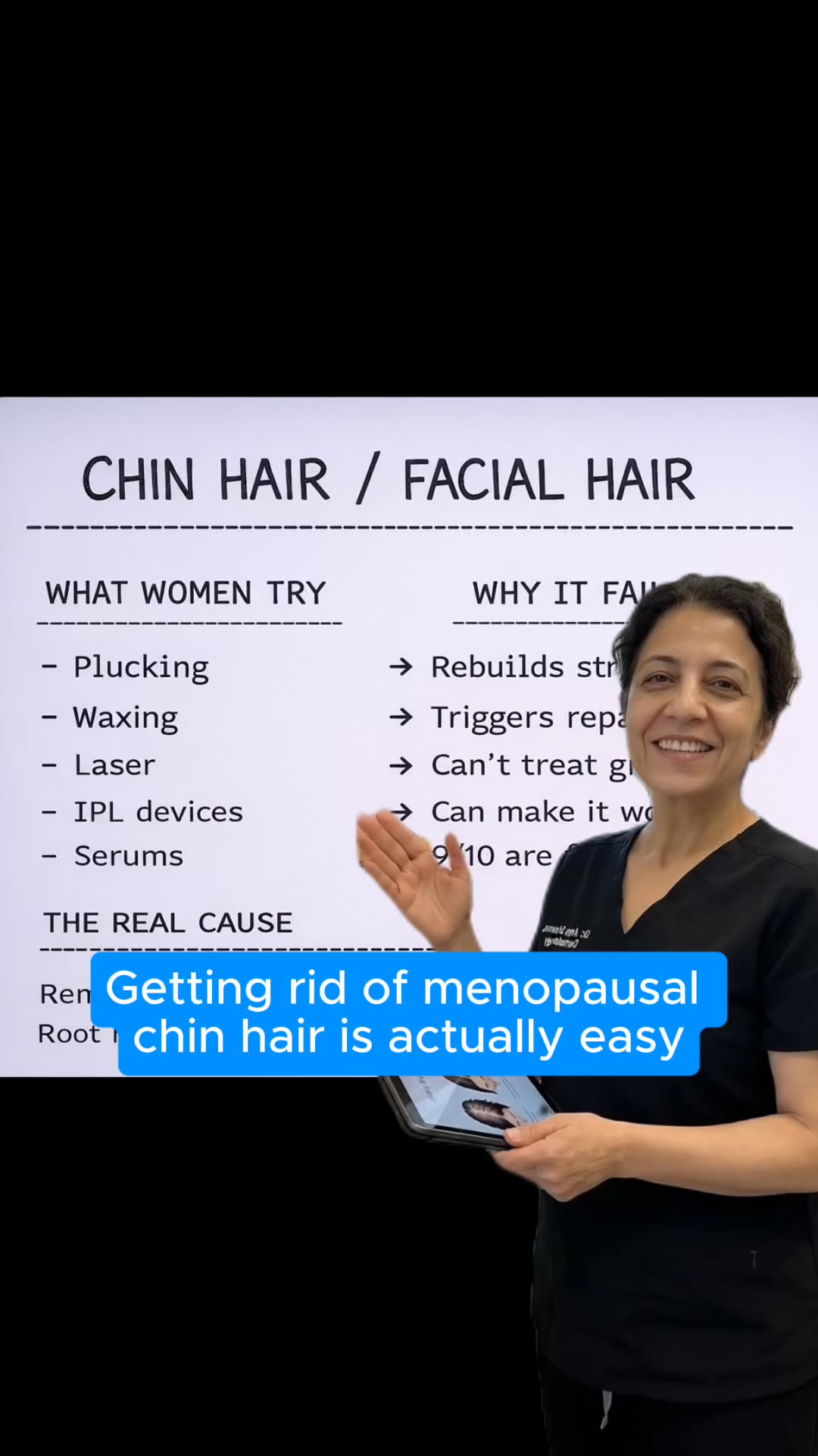 Stop your chin hair from growing back.