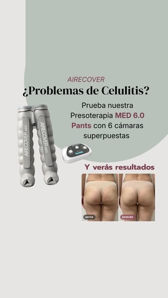 30 días de prueba + 3 años de garantía