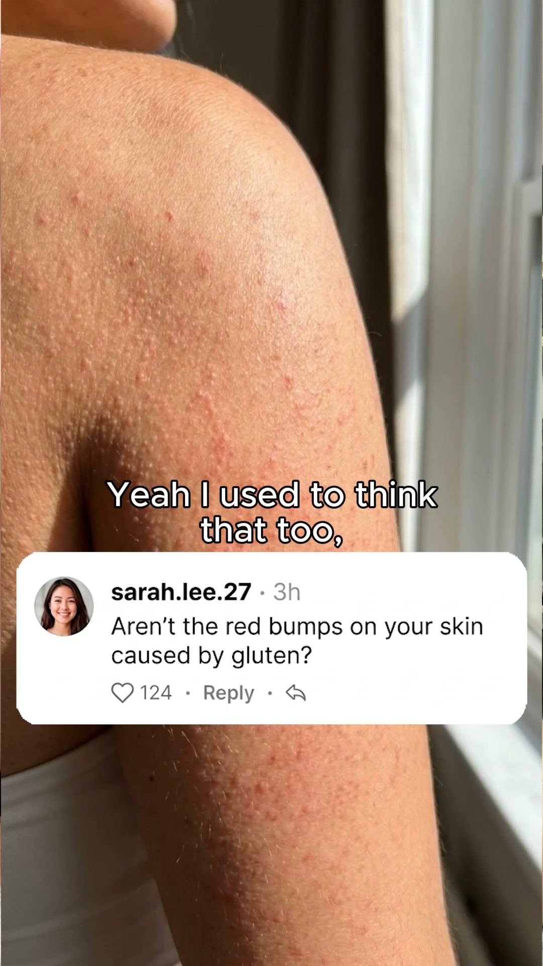 Get Strawberry 50% Off + Free Dry Brush