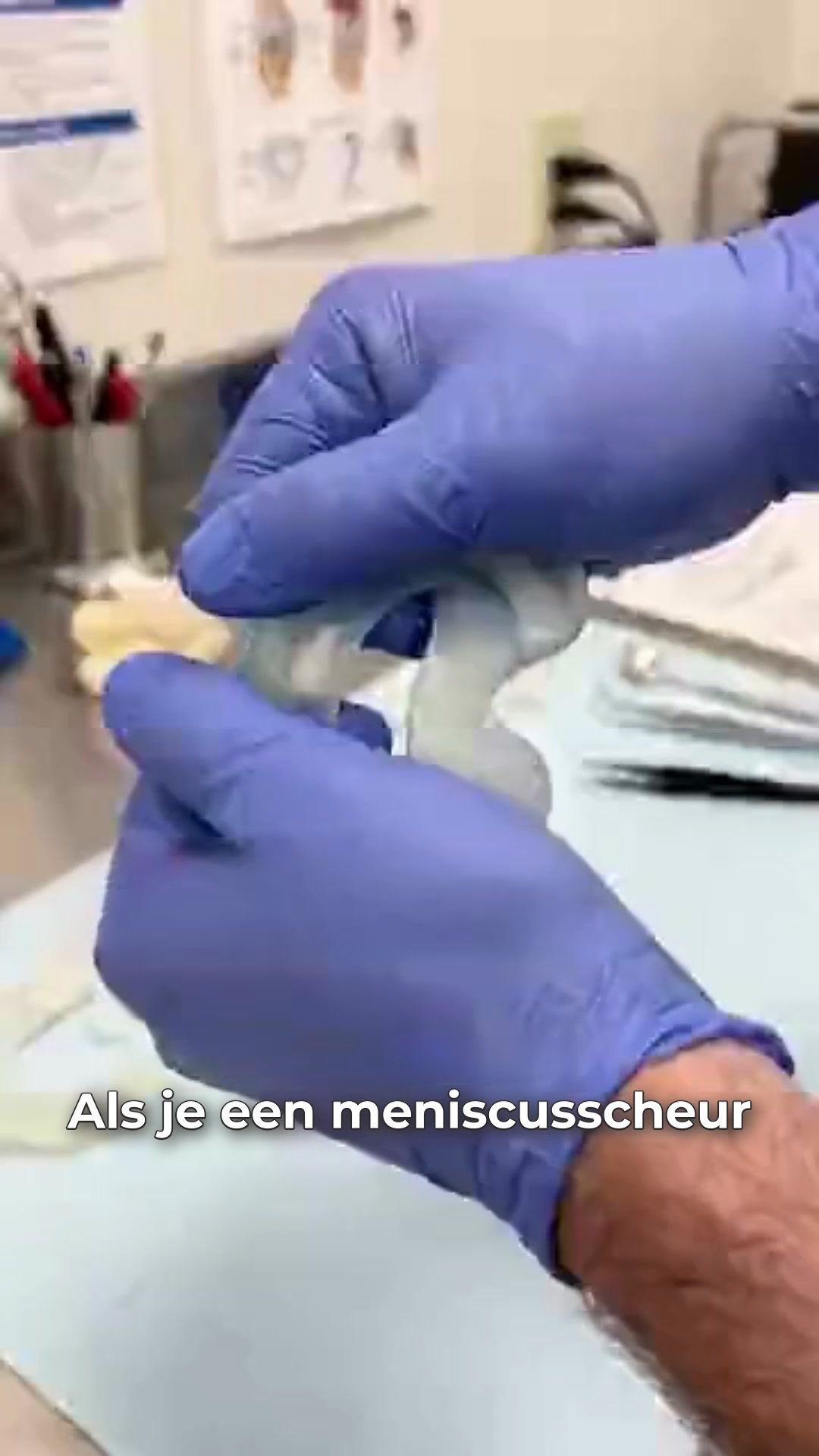 Kniepijn of artrose?