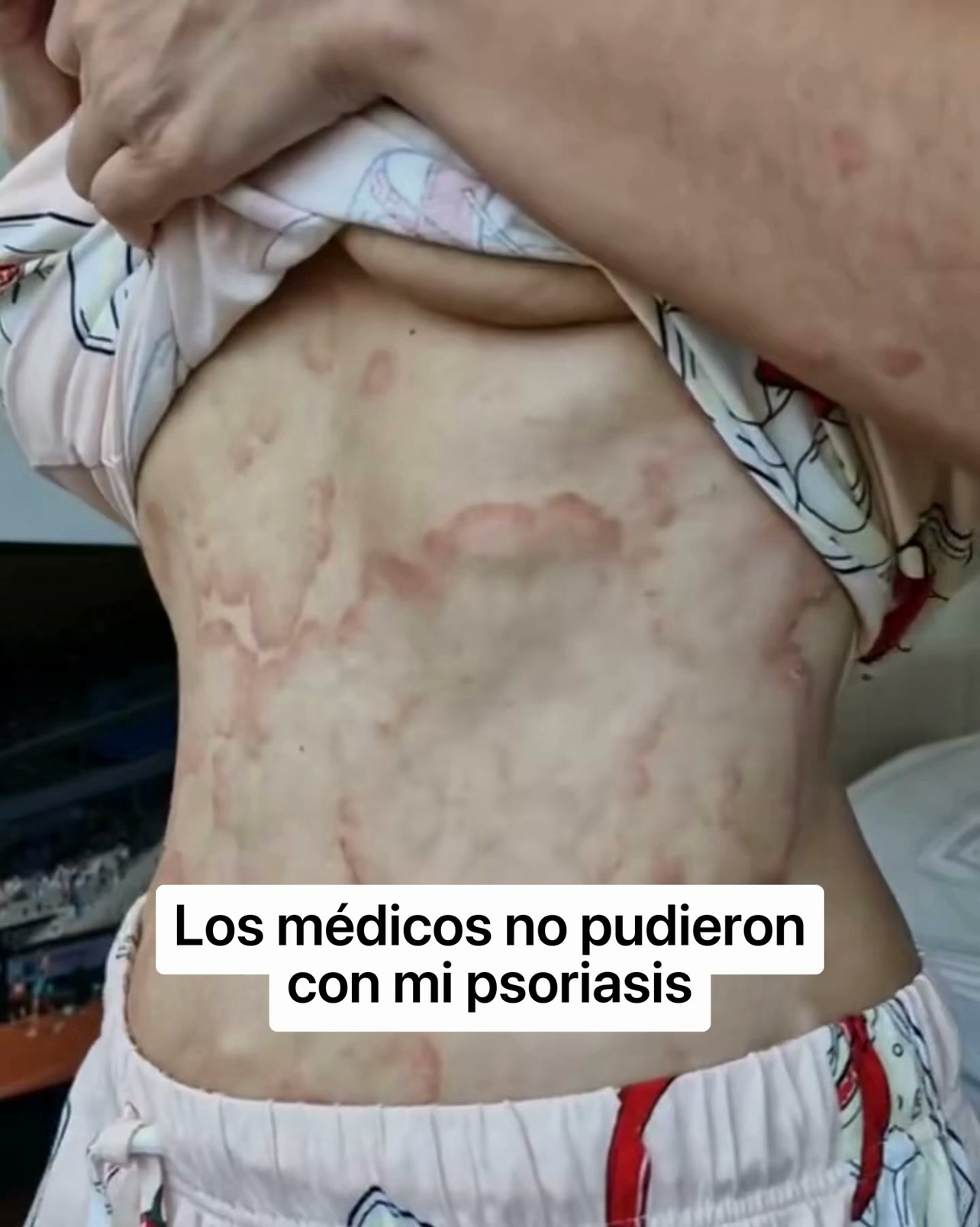 El bálsamo que nació en una colmena