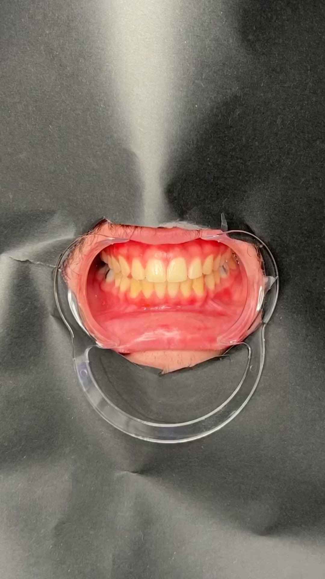 Tu dentista no quiere que sepas que esto blanquea los dientes en 2 minutos
