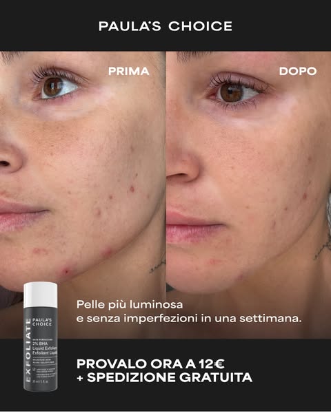 Scopri il nostro #1 bestseller