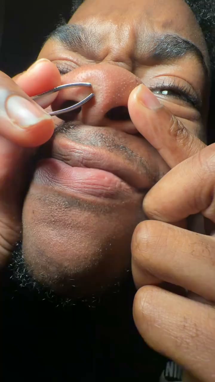 Clearer Pores In 2 Weeks