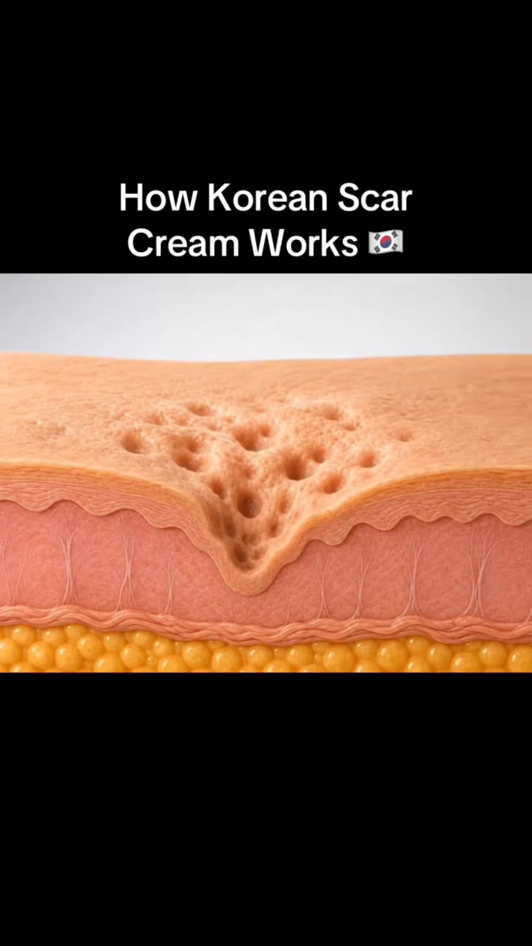 The Korean Answer To Acne’s Aftermath