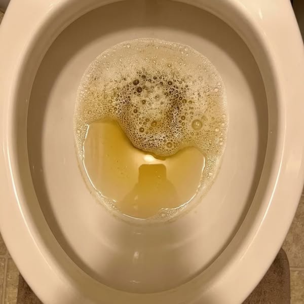 Leverdroppar utan fyllnadsmedel