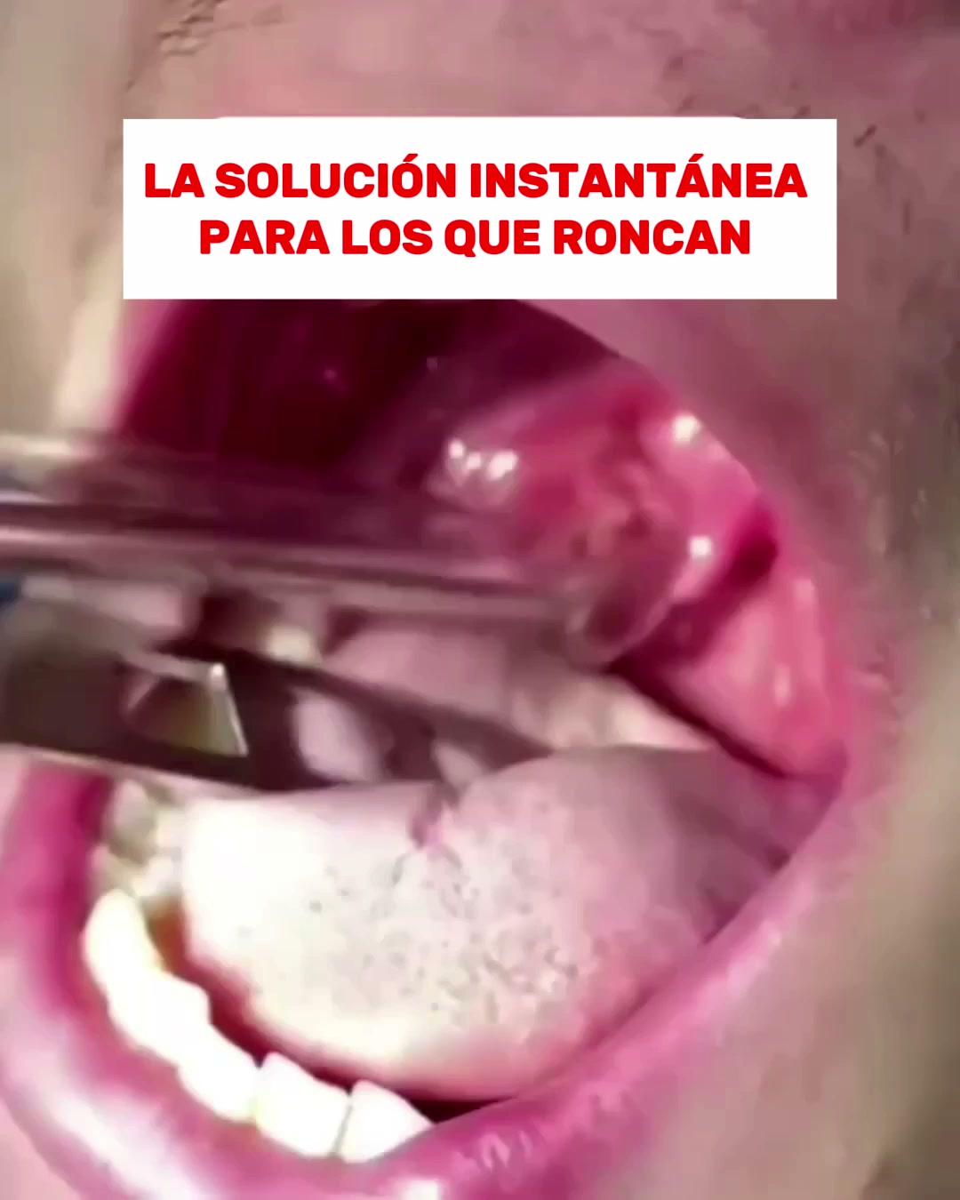 ¡Elimina los ronquidos desde la primera noche!