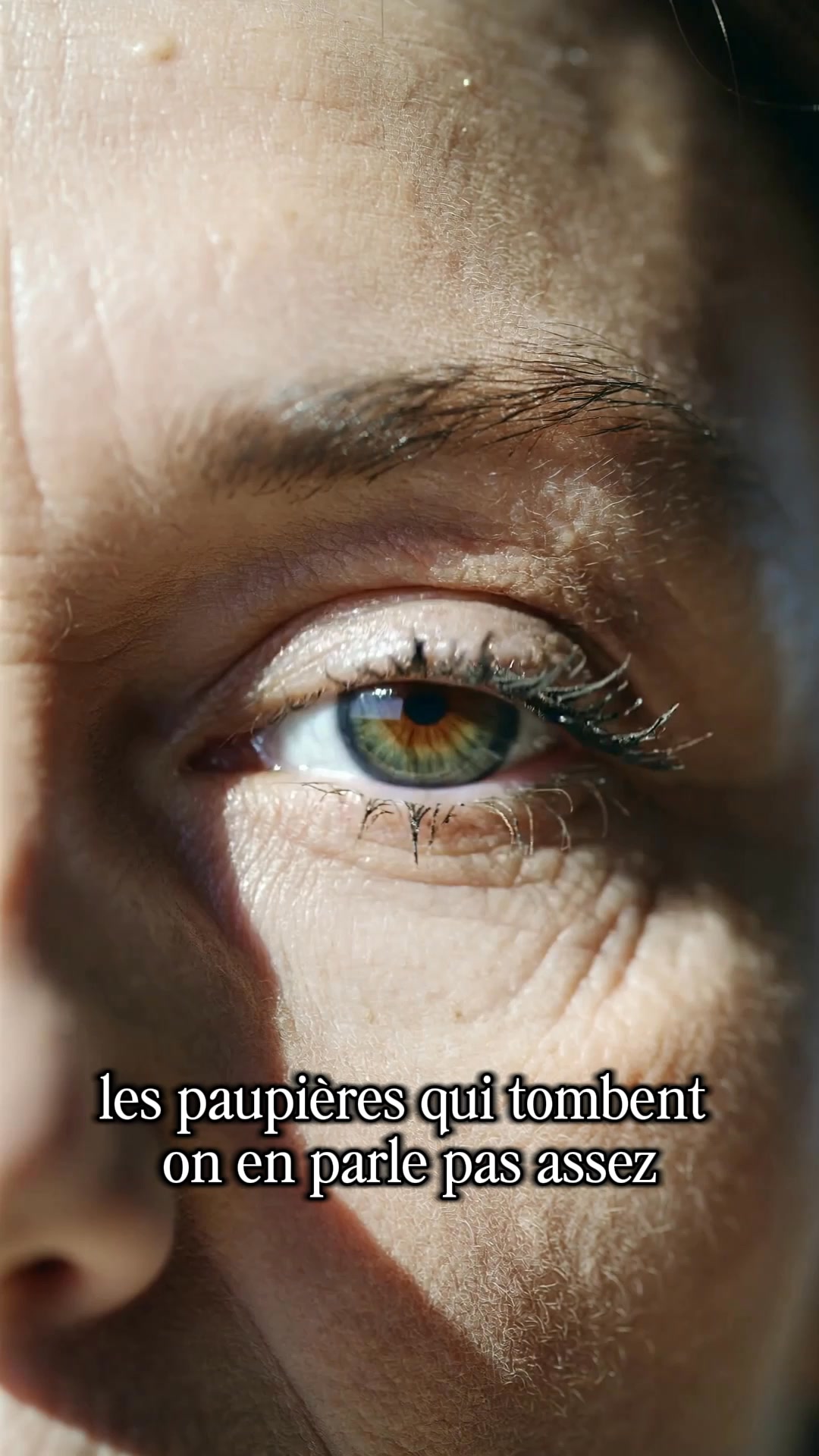 Donnez à vos paupières une chance avant la chirurgie