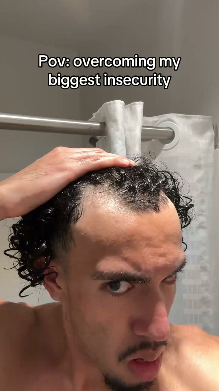The serum that replaces minoxidil | 70% OFF Today