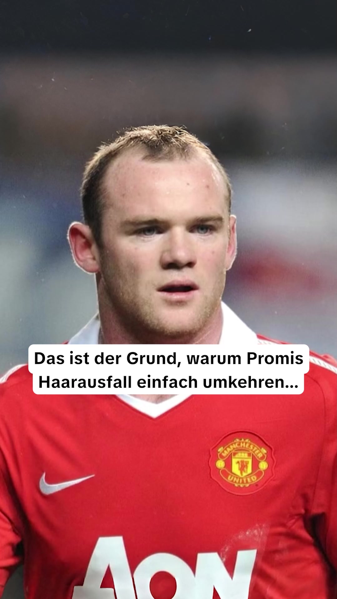 Volles Haar in 3-5 Wochen oder Geld zurück.