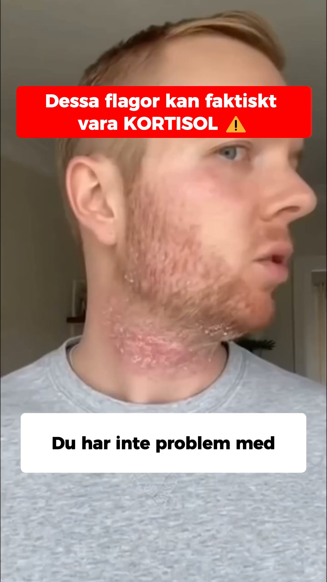Sluta klia direkt med ZeroItch
