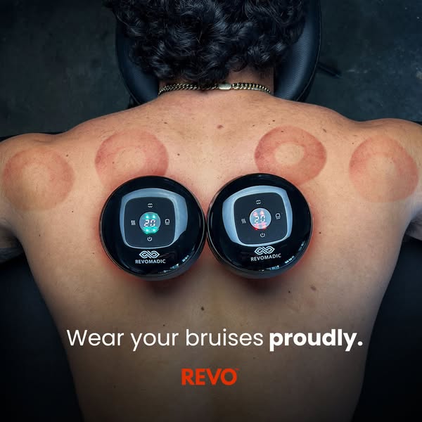 It's not an alternative, it's the solution | REVO™