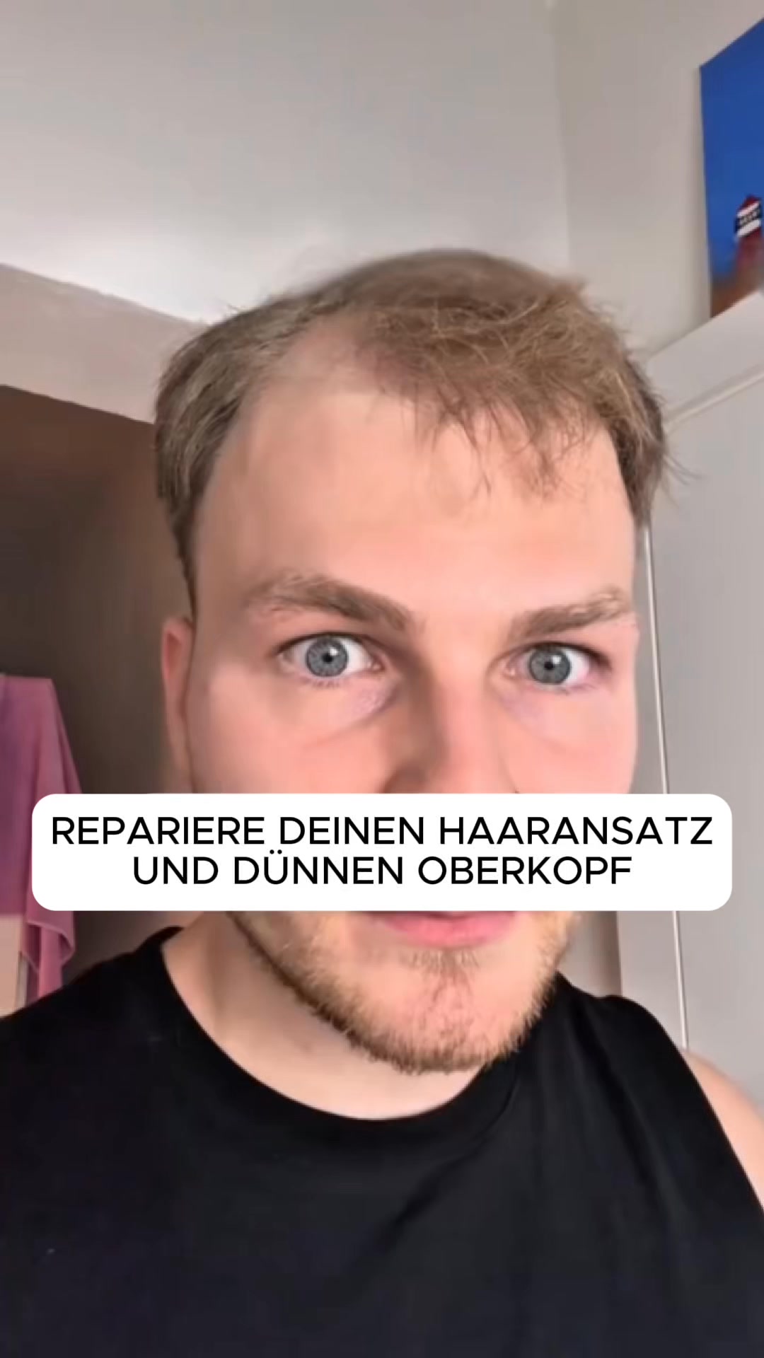 Hol dir noch heute volleres und dickeres Haar zurück!