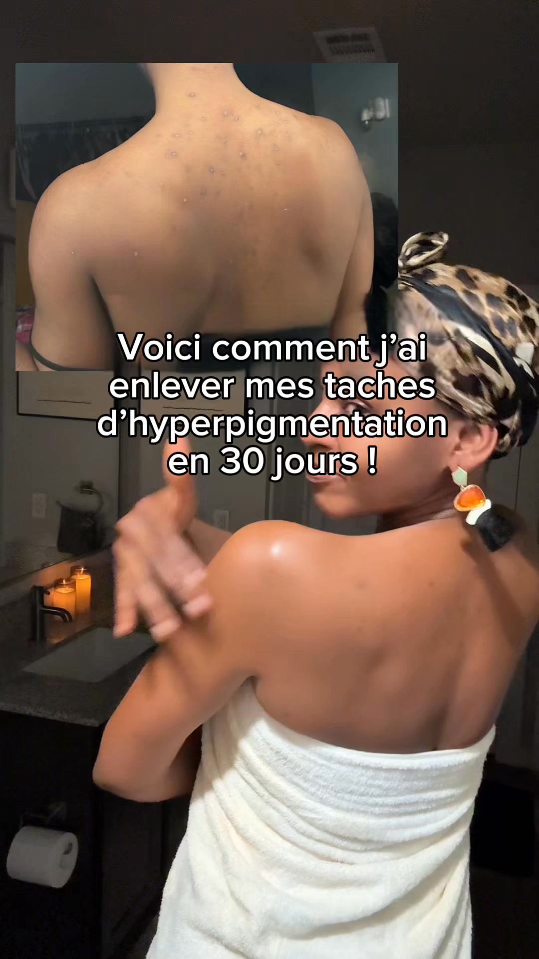 Votre nouvelle routine anti-taches