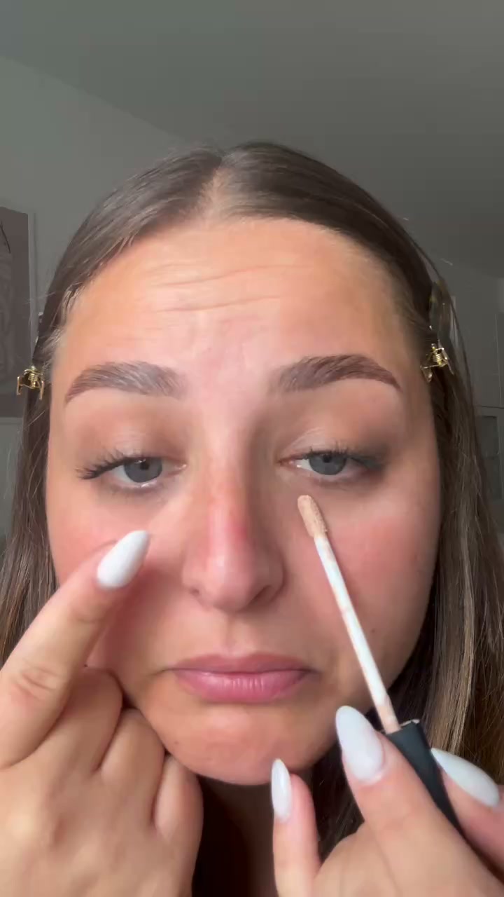 Augenringe reduzieren