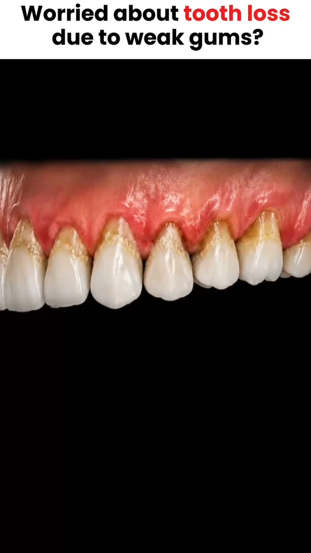 Dentist-Approved Gum Care