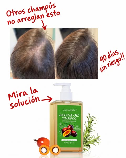 Adios a la Caida del Cabello. OFERTA 2x1 por 29,90