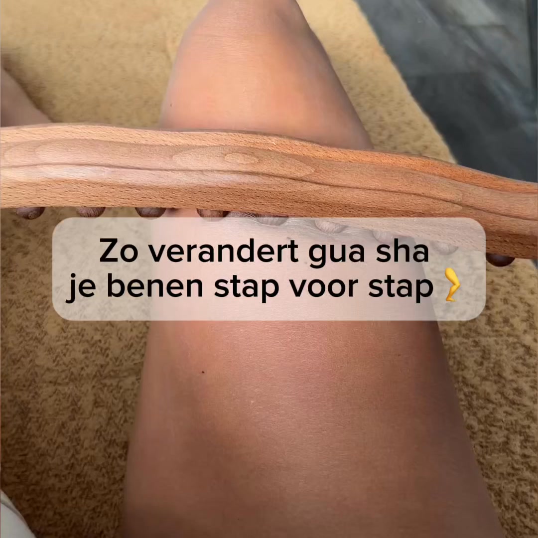 10.000+ verkocht