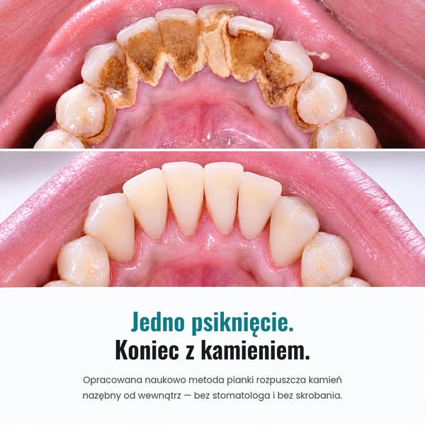 Dlatego pasta do zębów nigdy tak naprawdę nie rozwiązuje problemu nieświeżego oddechu