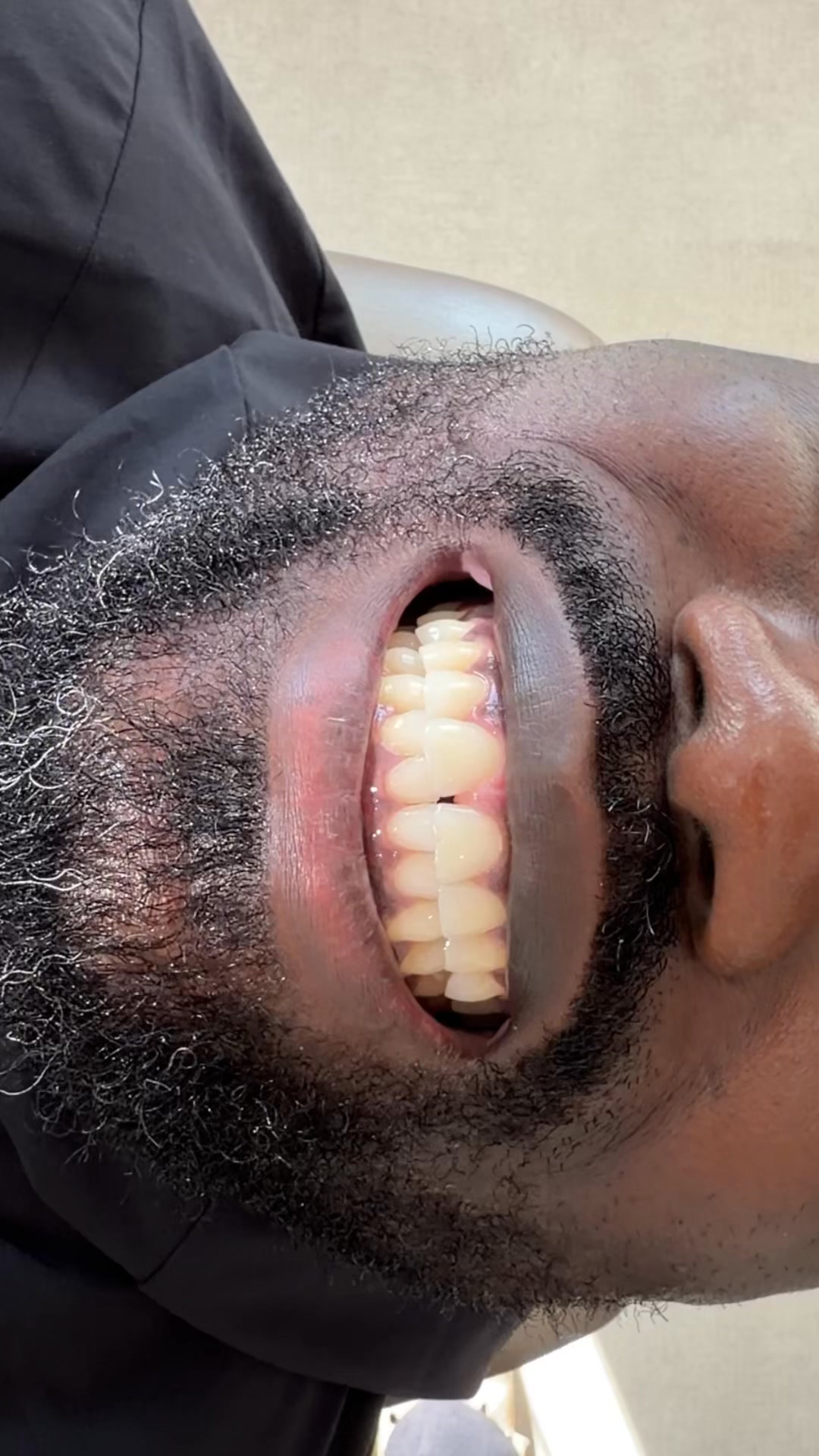 Unlock Your Best Smile Without Fear or Embarrassment