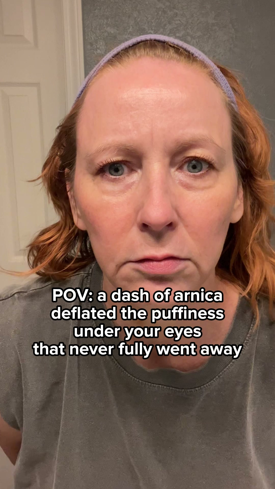 “I found the holy grail of skincare”