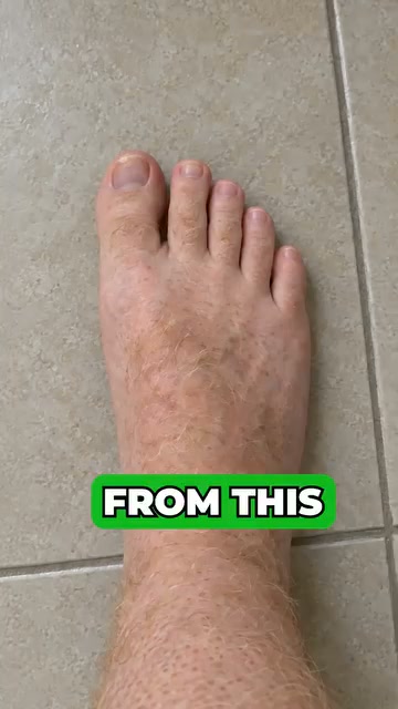 The Real Reason You’re Hiding Feet