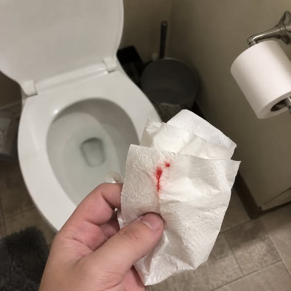 No More Flares. No More Bleeding.