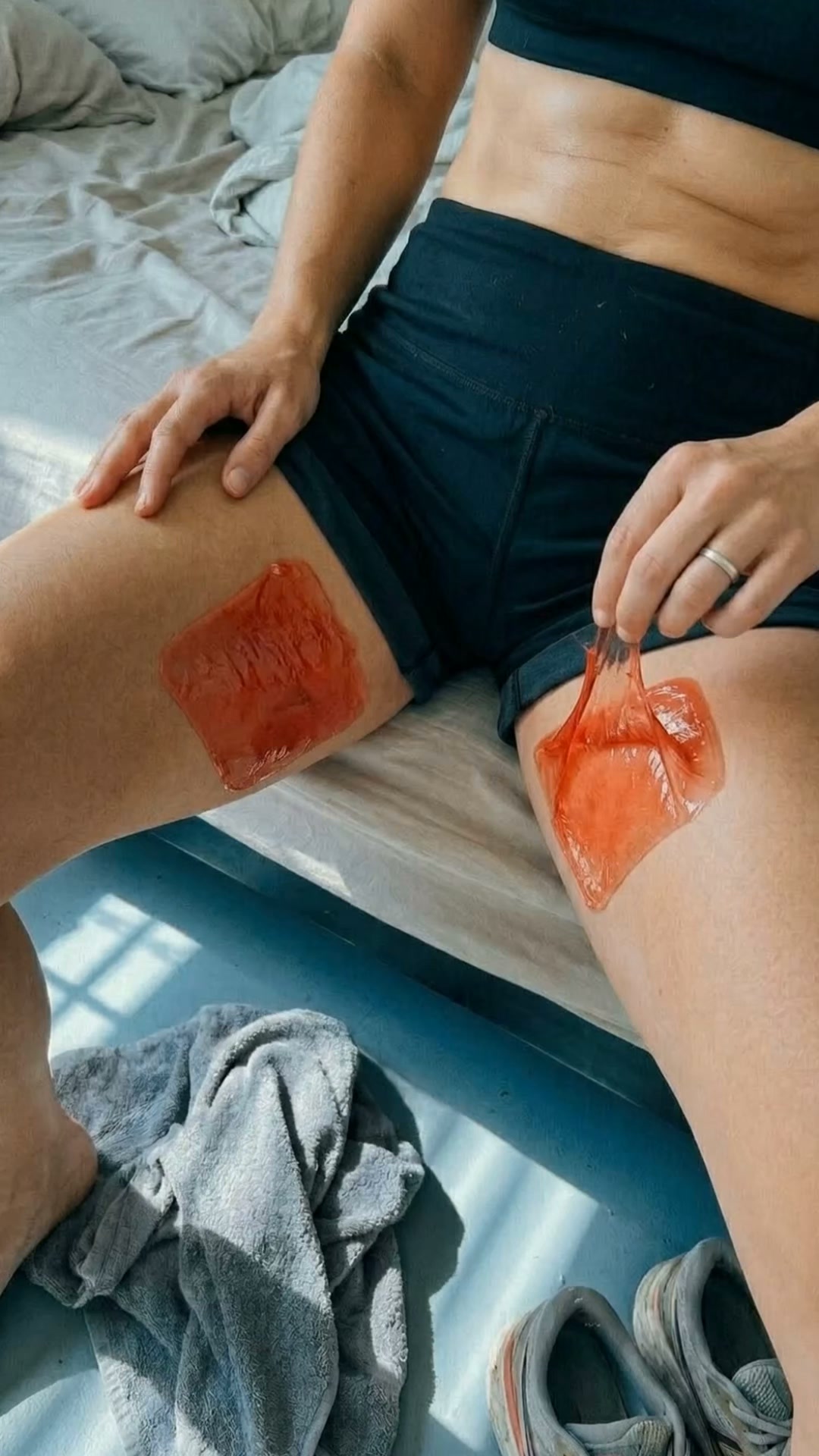 Stop The Skin Fold Rash Coming Back