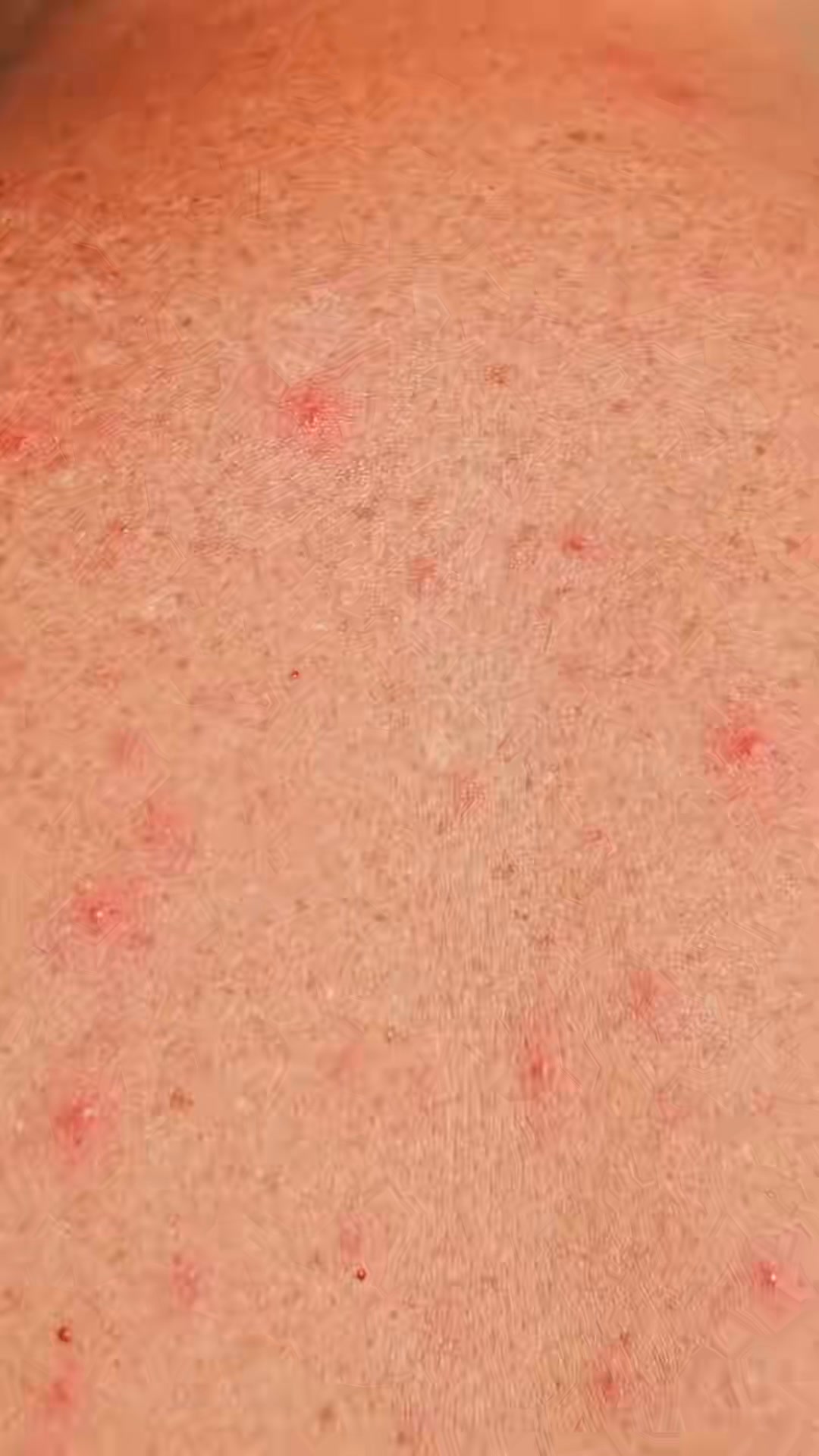 Ese picor no es la edad. Es piel acumulada.