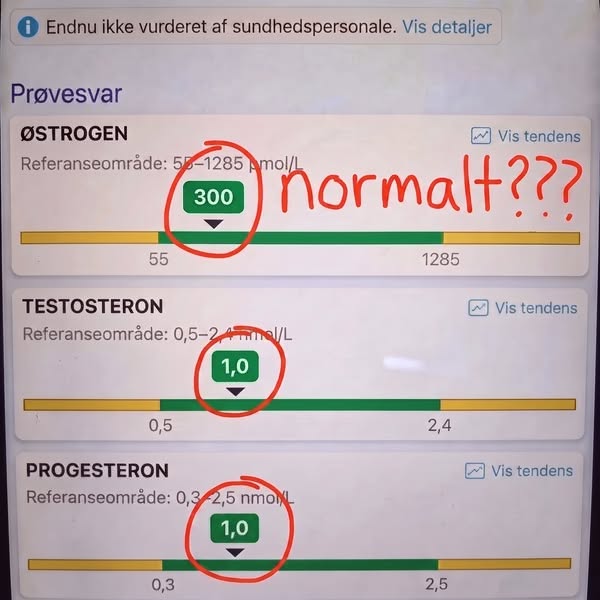 Læs det her, hvis du vil have din lyst tilbage