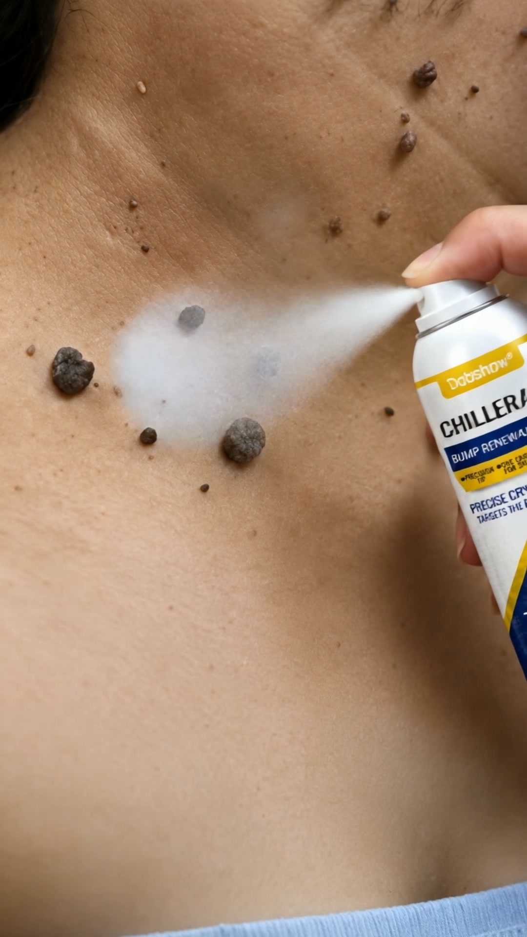 Precision Cooling. Targeted Skin Renewal.