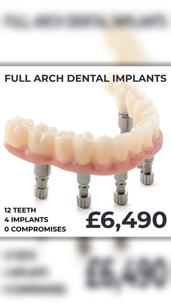 Full Arch Dental Implants From £6,490