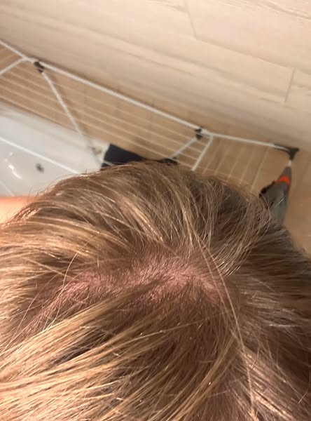 This Saved My Hair