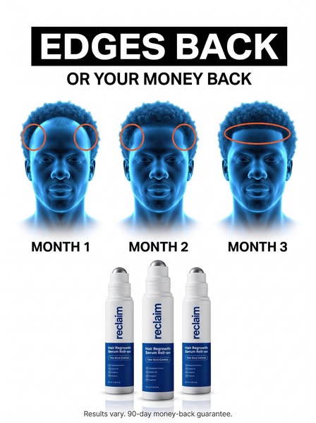 Edges Back or Your Money Back