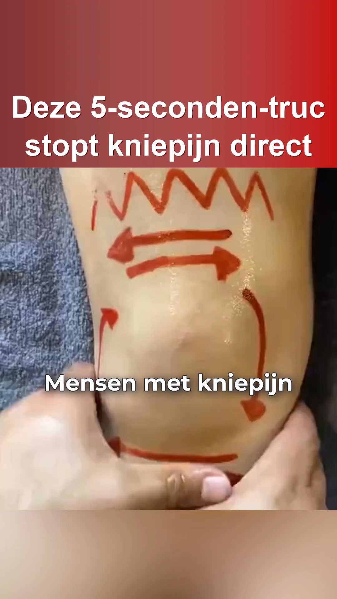 Kniepijn of artrose?