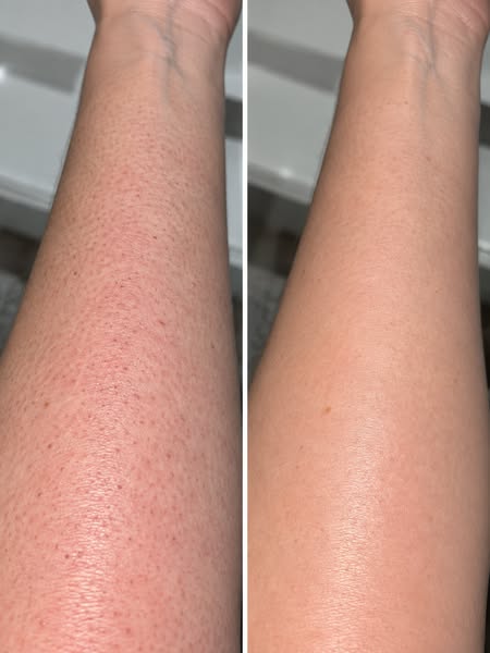 A KP Routine for Rough Thighs