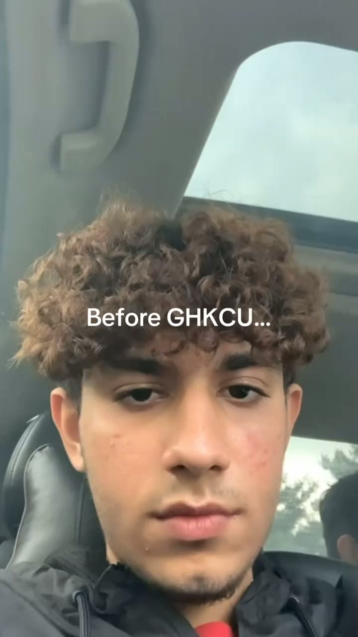 Clearer Skin Starts Here