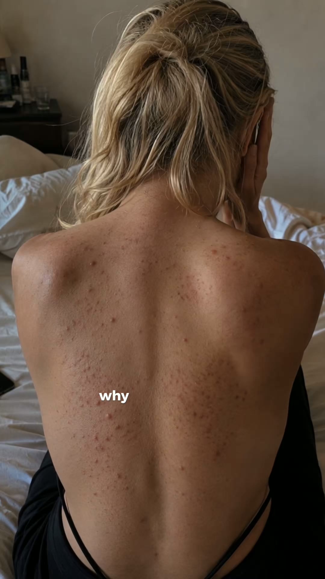 Clear Skin or IT'S FREE!